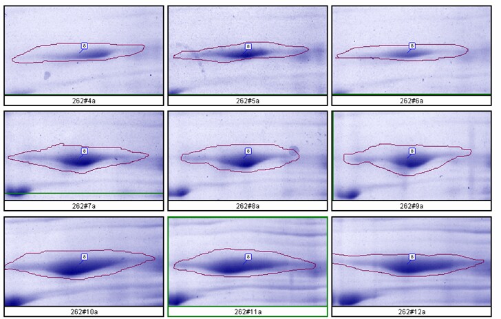 2D gel analysis shows Coomassie blue stain is quantitative in 2D SDS PAGE gel for most proteins