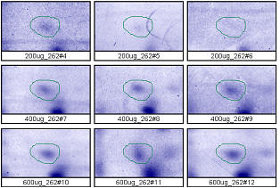 2D gel analysis: faint protein spot of MW 14 kD, pl 5.7. Spot outlines in 9 gels loaded 200-600 μg