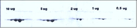 2D electrophoreis gel increasing loads 0.5- 10 micrograms of actin