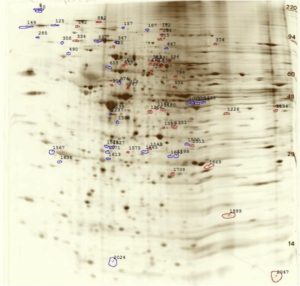 2D gel analysis of Hurler syndrome to find up/down regulated proteins. Proteins ID’d by Mass spec