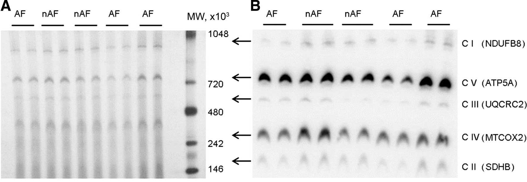 1D blue native gel and western blots of human atrial tissue