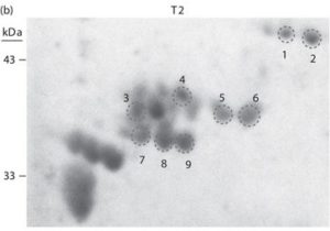 2D Western blot human brain probed with plasma-collected acute/subacute time points after injury