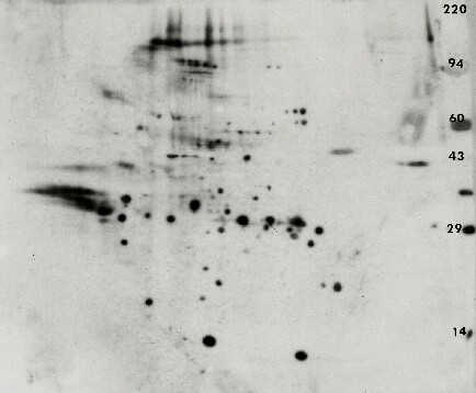 Anti-phosphotyrosine/pY/pTyr 2D Western blot from an erythroid progenitors sample. 