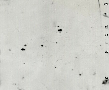 Phosphotyrosine 2D Western blot: PY20 antibody against rat retinal pigment, eye epithelium