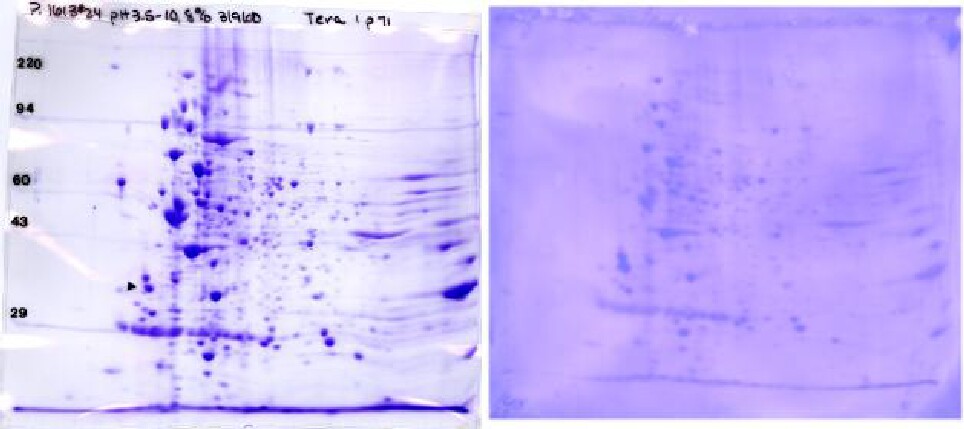Eukaryotic Tera I: PVDF staining to match coomassie-stained 2D gel & PVDF to ID spots by LC/MS