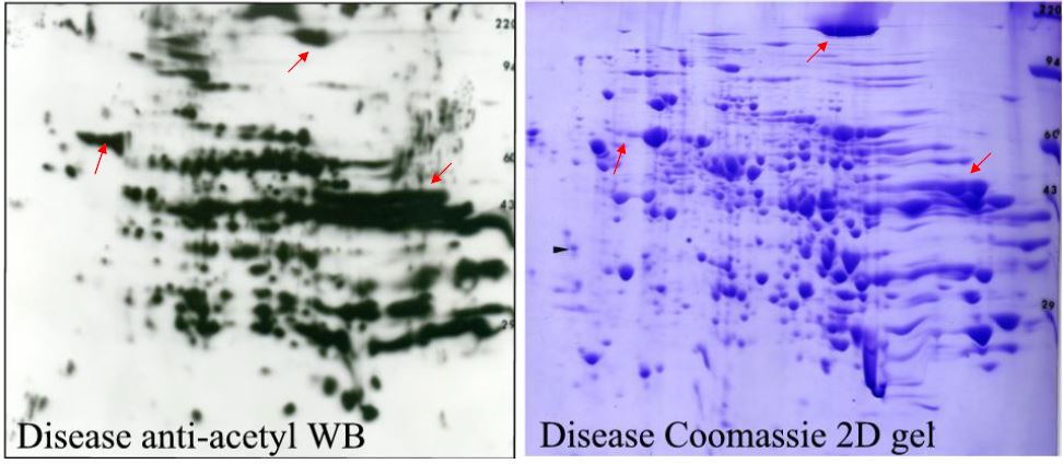 Acetyl-Lysine 2D WB match to Coomassie gel for spot cutouts to ID acetylated proteins by Mass Spec