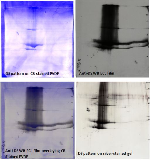 Anti-drug substance 2D western blot: stained PVDF, anti-DS 2D film, overlay image, 2D gel