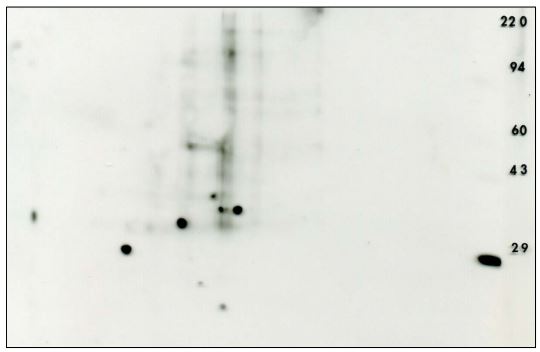 Phosphotyrosine 2D Western blot siRNA mouse embryonic fibroblast + control Carbonic Anhydrase 29kD