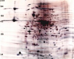 Bacteria / Yeast Bacteria / Yeast