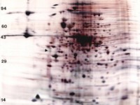 Bacteria / Yeast