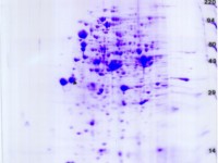 E. coli