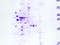 S. mutans